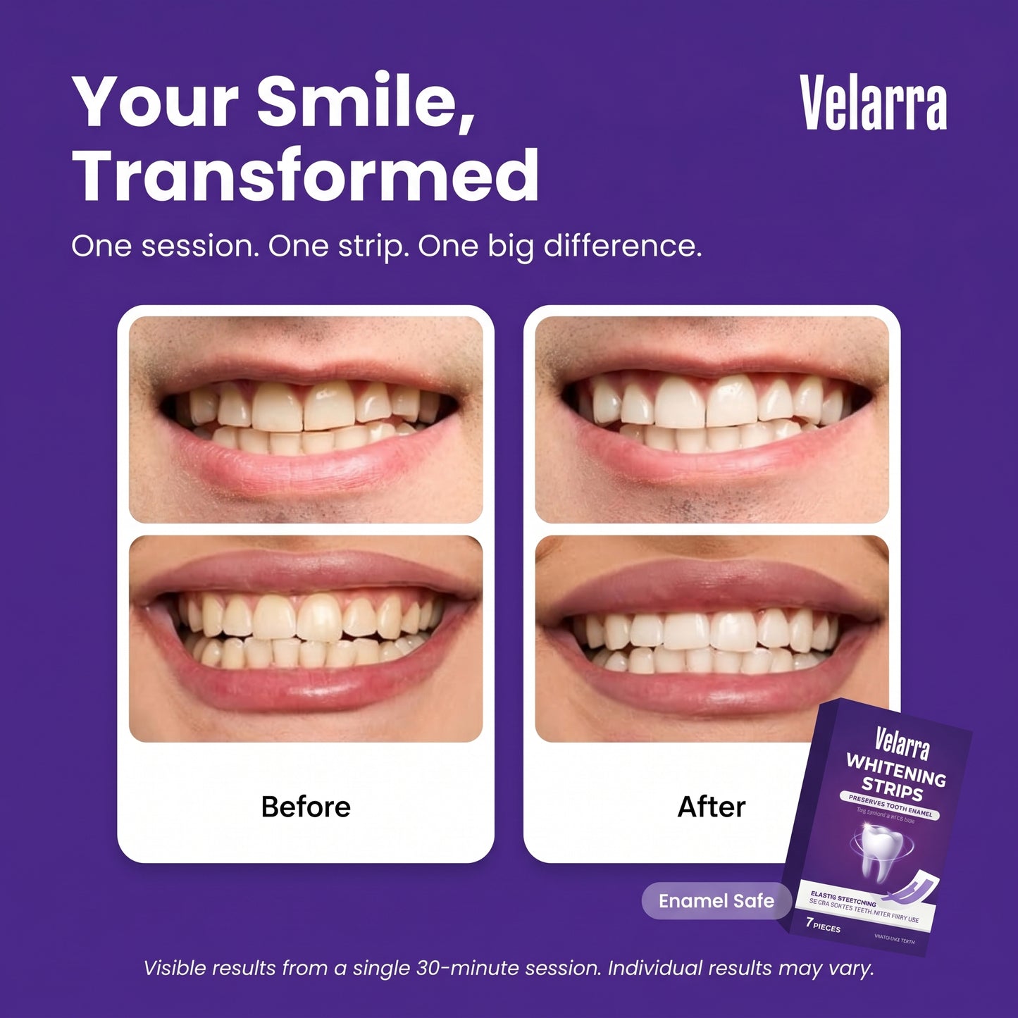 Whitening Strips
