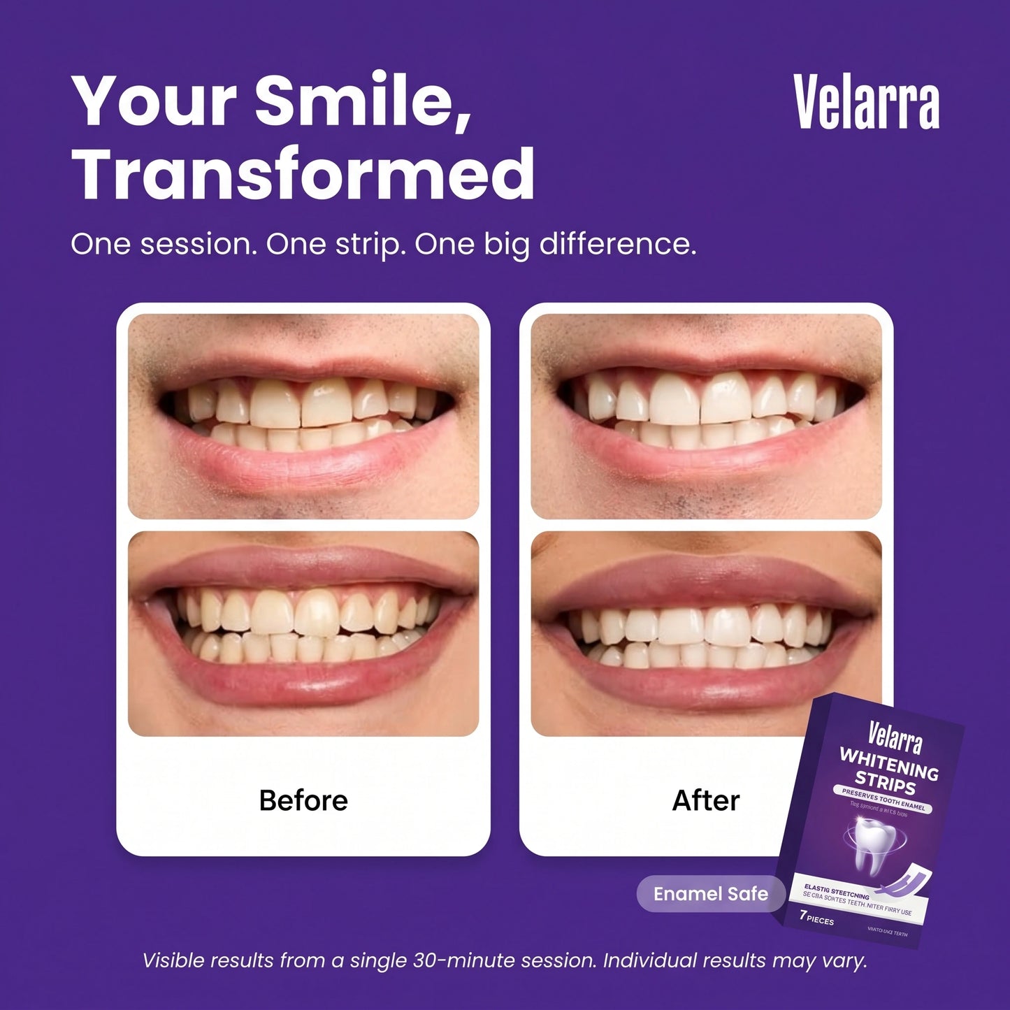 Whitening Strips